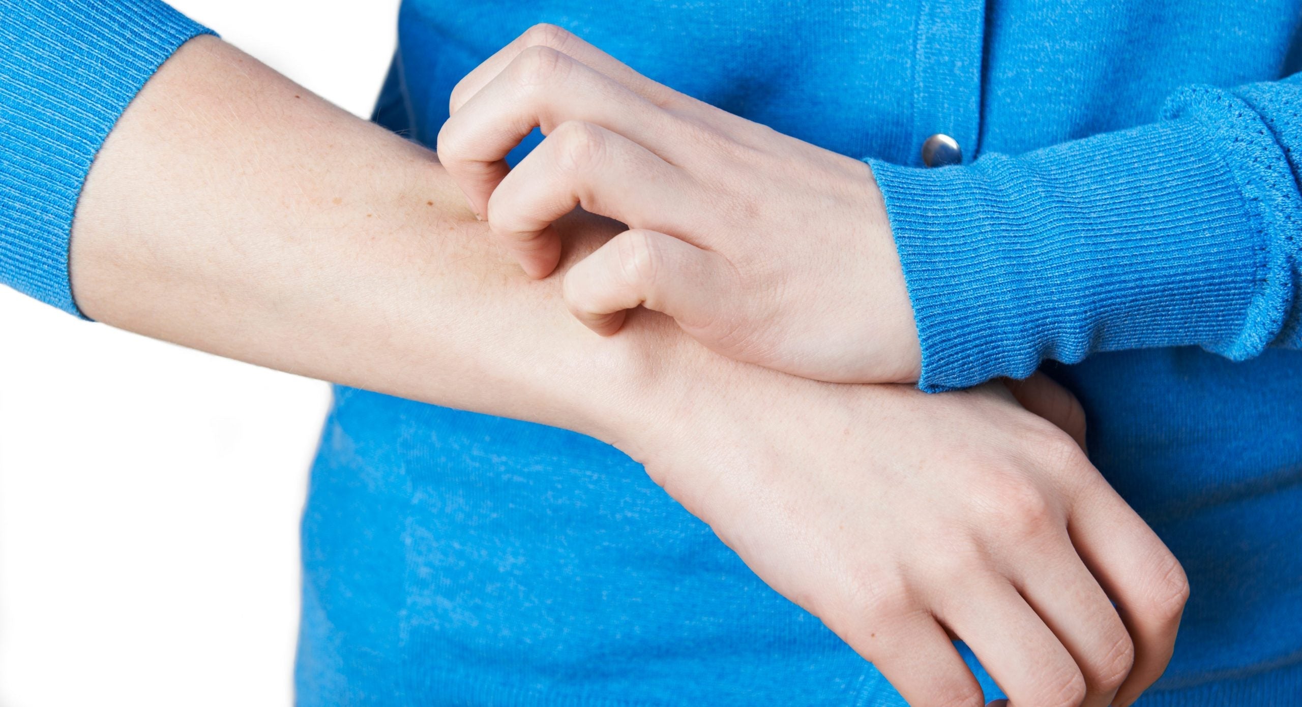 7 gode råd: Leverbetinget graviditetskløe