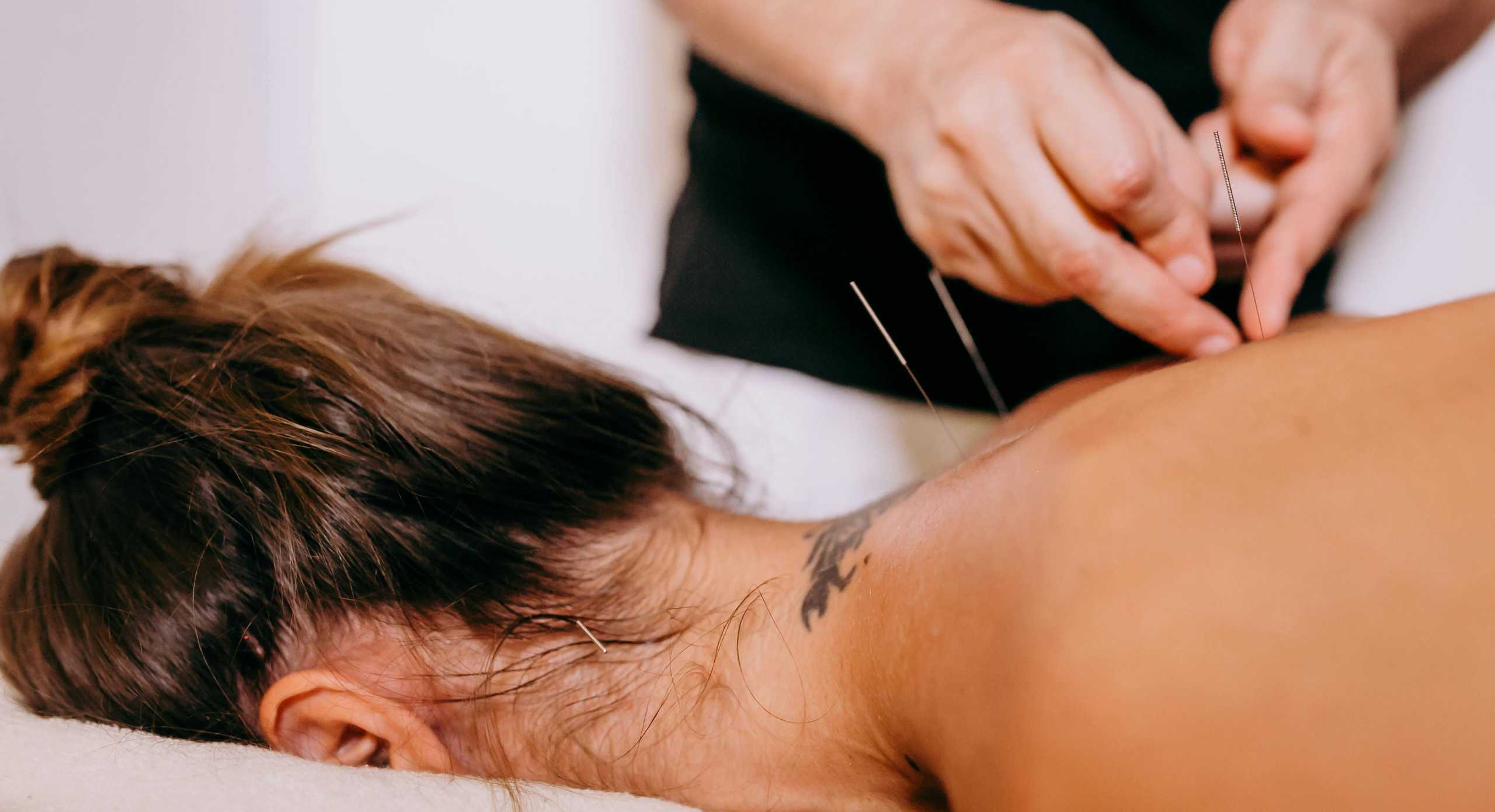 Modningsakupunktur - virker det egentligt?