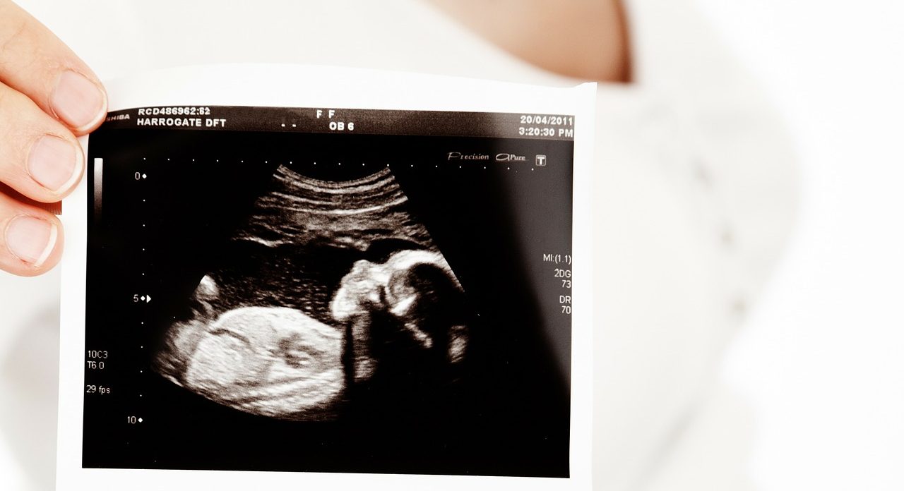 Sådan ser du kønnet på baby ved hjælp af nub teori