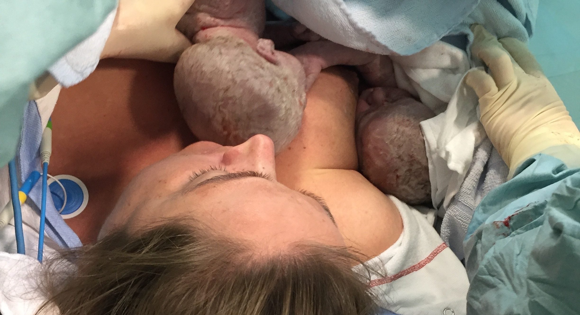 ”Der lå jeg så med ar i maven og to små smukke børn og blev skammet, fordi jeg havde født ved kejsersnit”