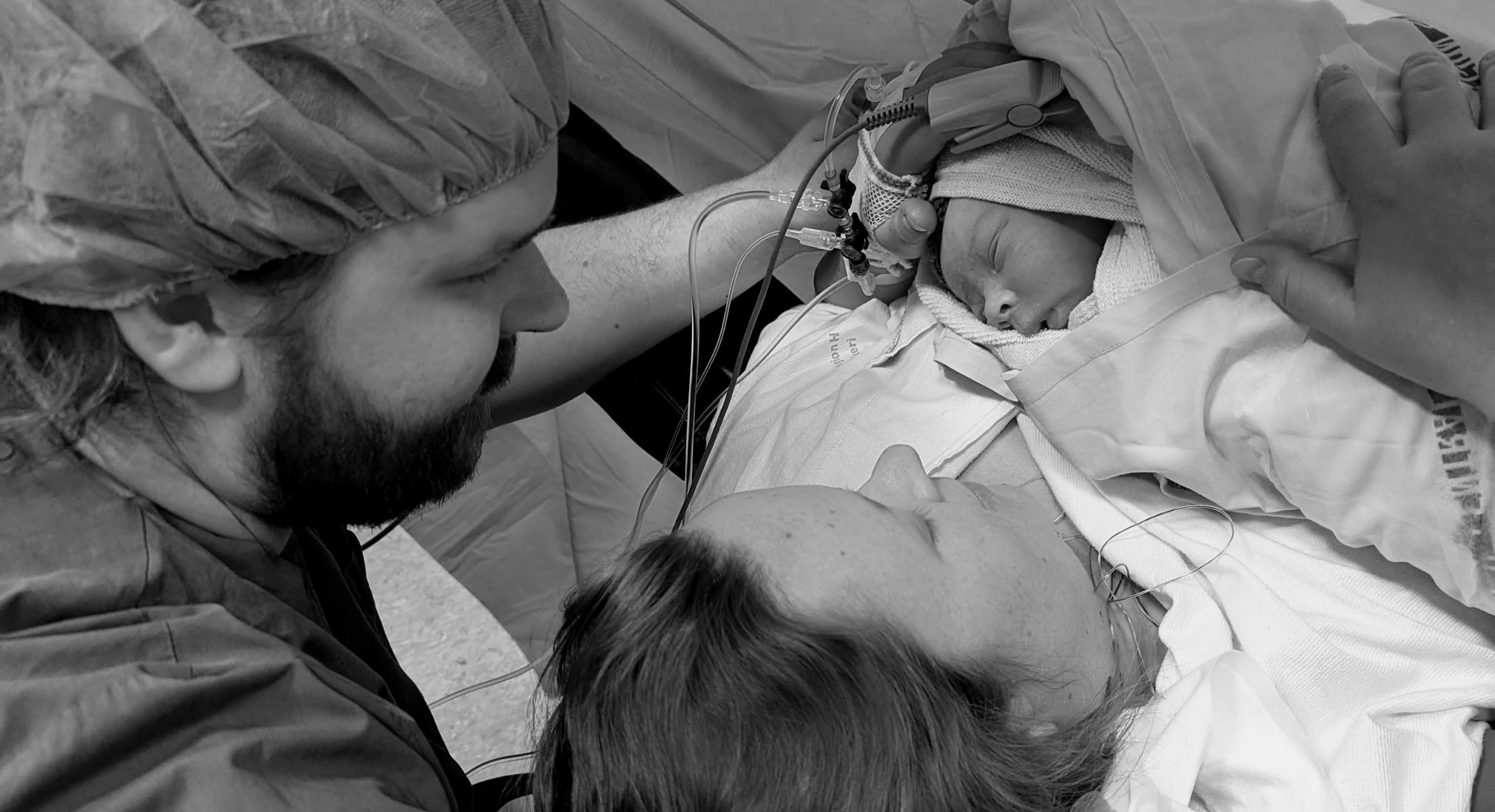 “At føde ved kejsersnit er noget, jeg forstod med kroppen før hjernen”