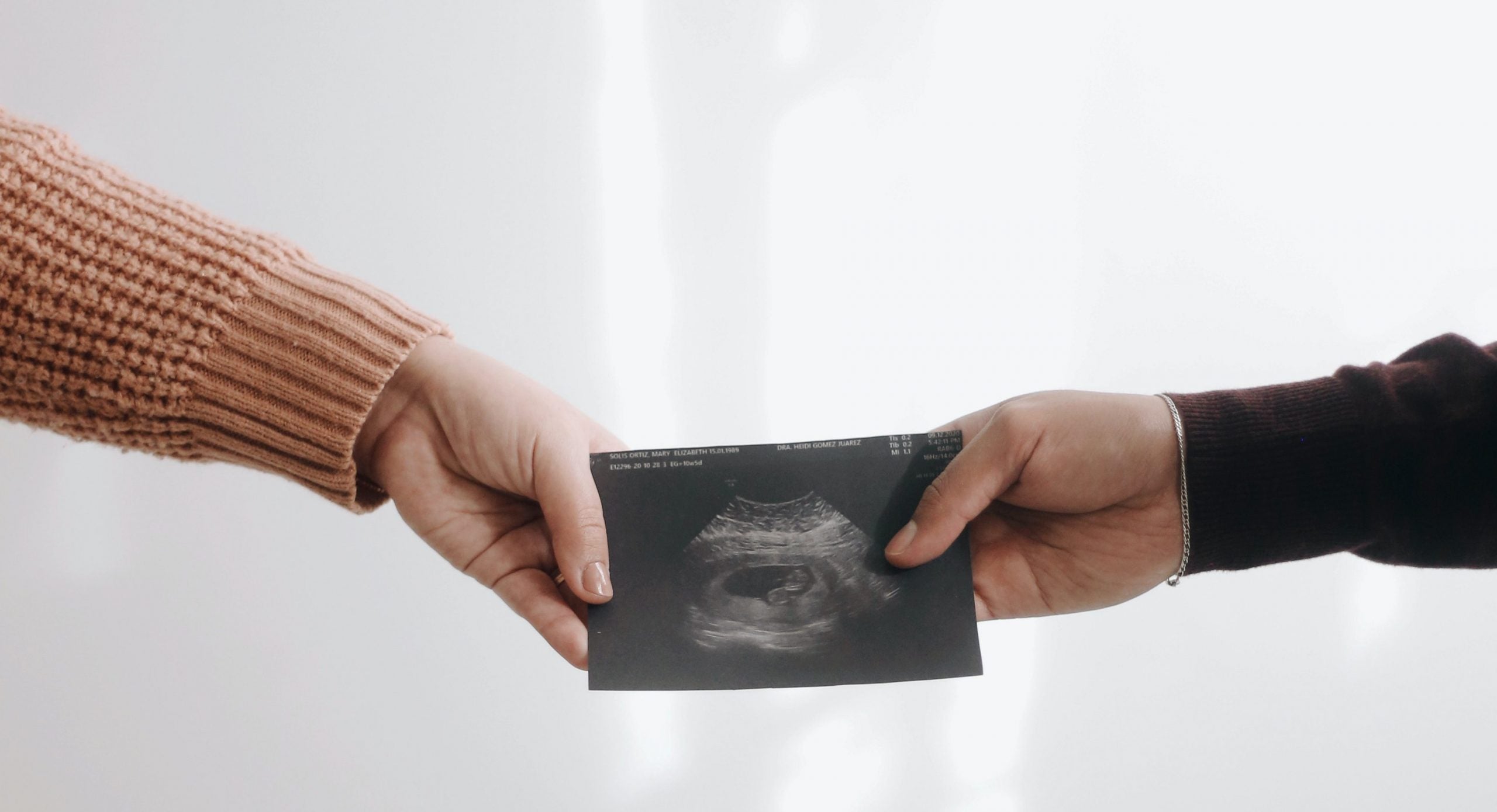 terminsberegner to hænder der holder et ultralydsbillede