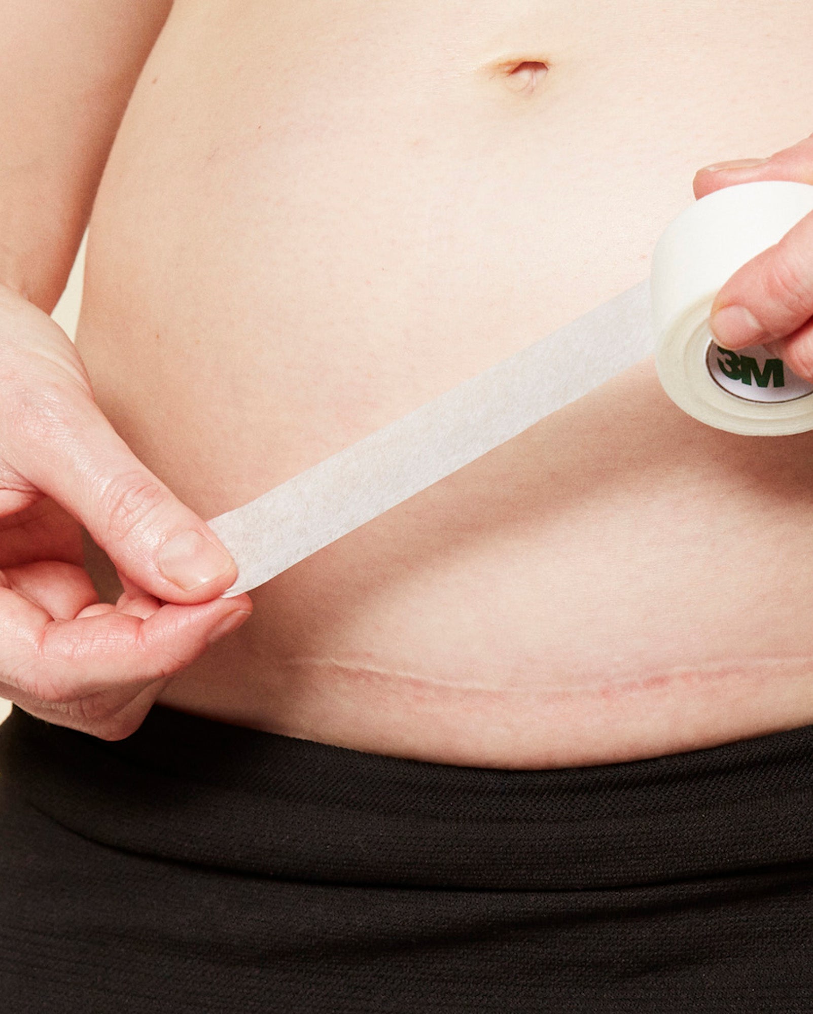 Englehud plaster fra momkind som skal sættes på kvindes kejsersnit ar på maven.