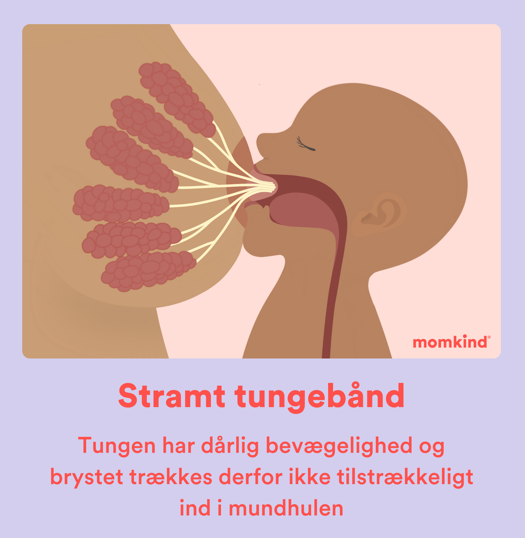 stramt tungebånd sutteteknik