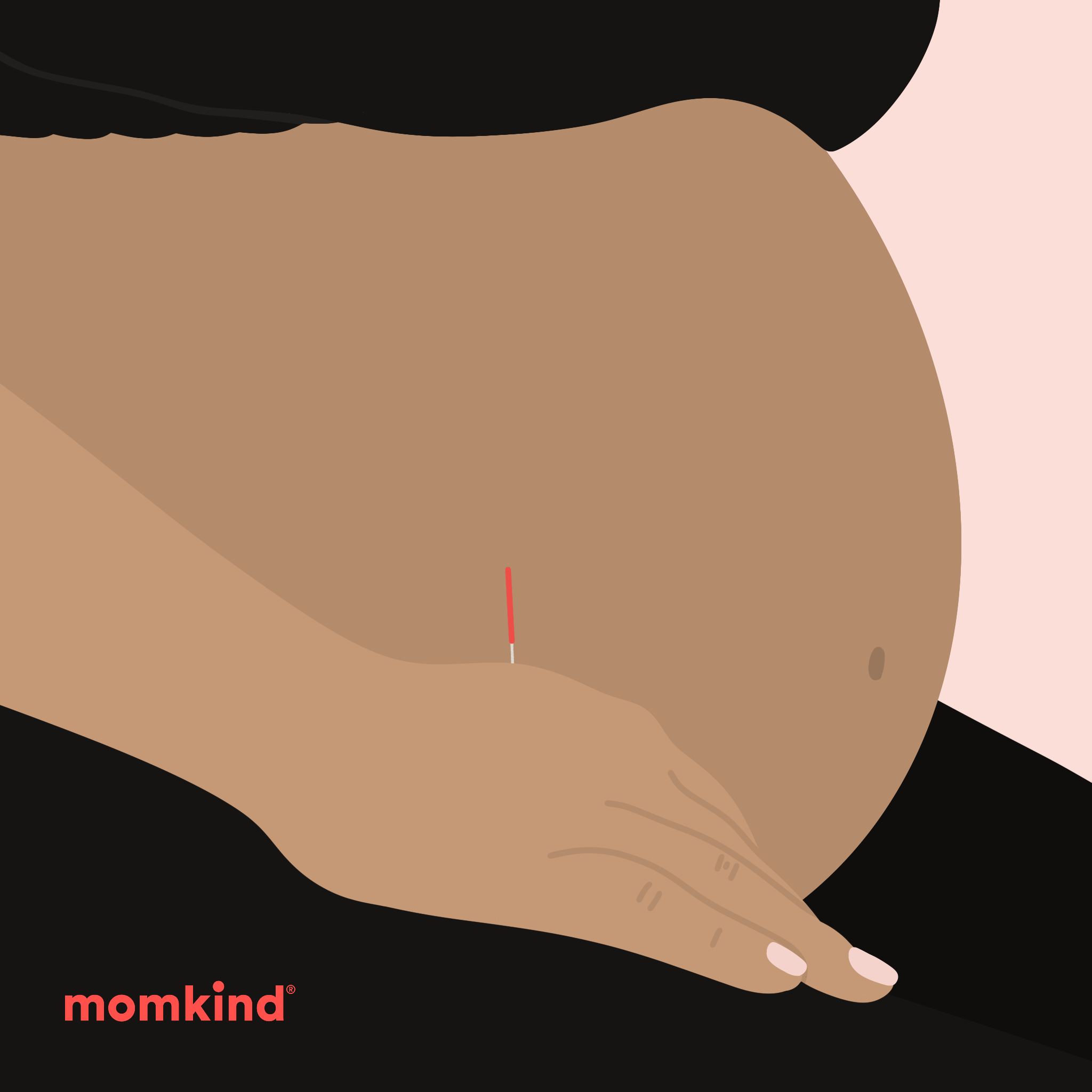 gravid akupunktur
