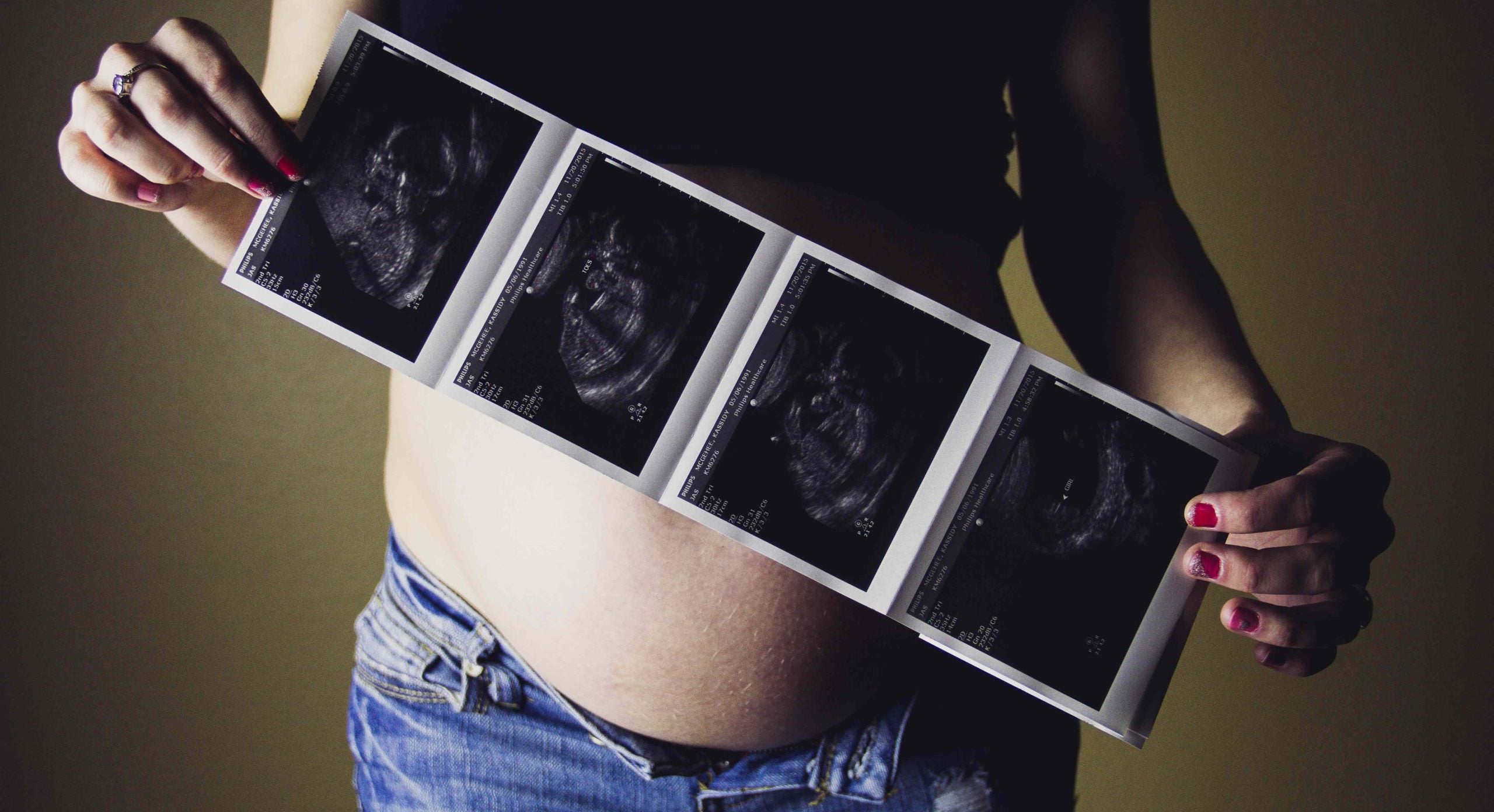 Misdannelsesscanning – guide til graviditetsundersøgelsen i 2. trimester