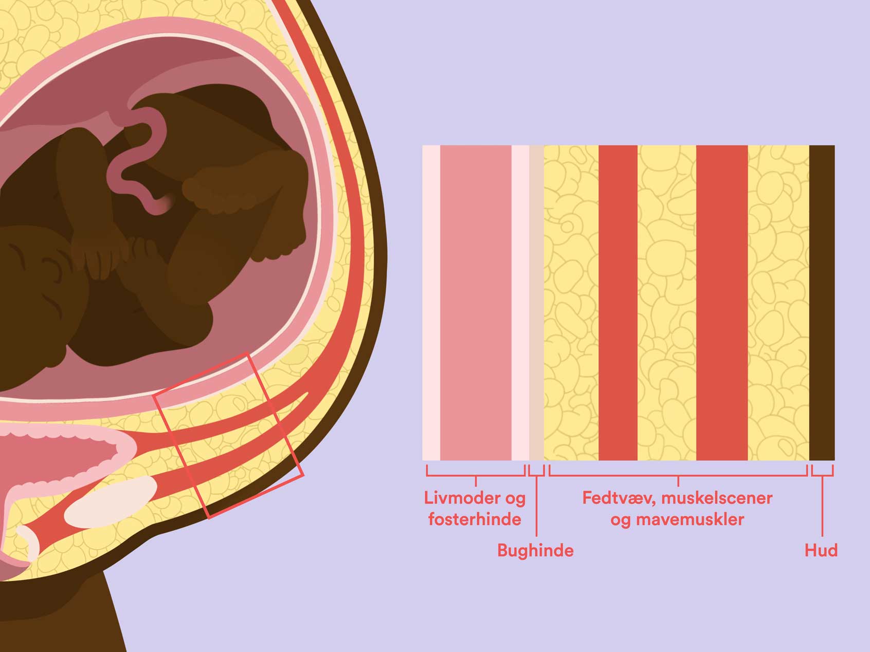 illustration der viser de lag som skæres igennem ved kejsersnit