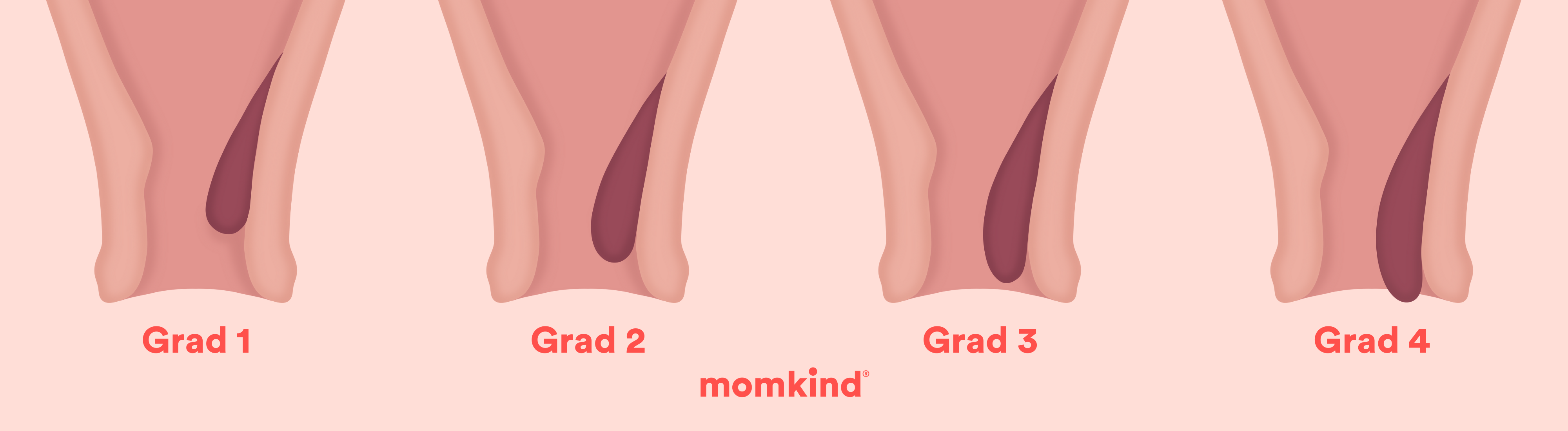 hæmorider illustration fire grader