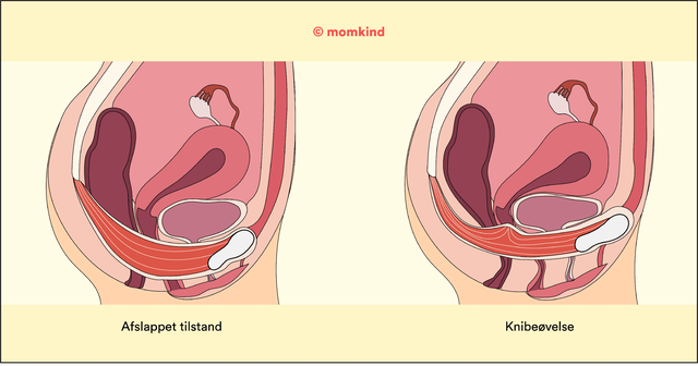 momkind illustration af knibeøvelse